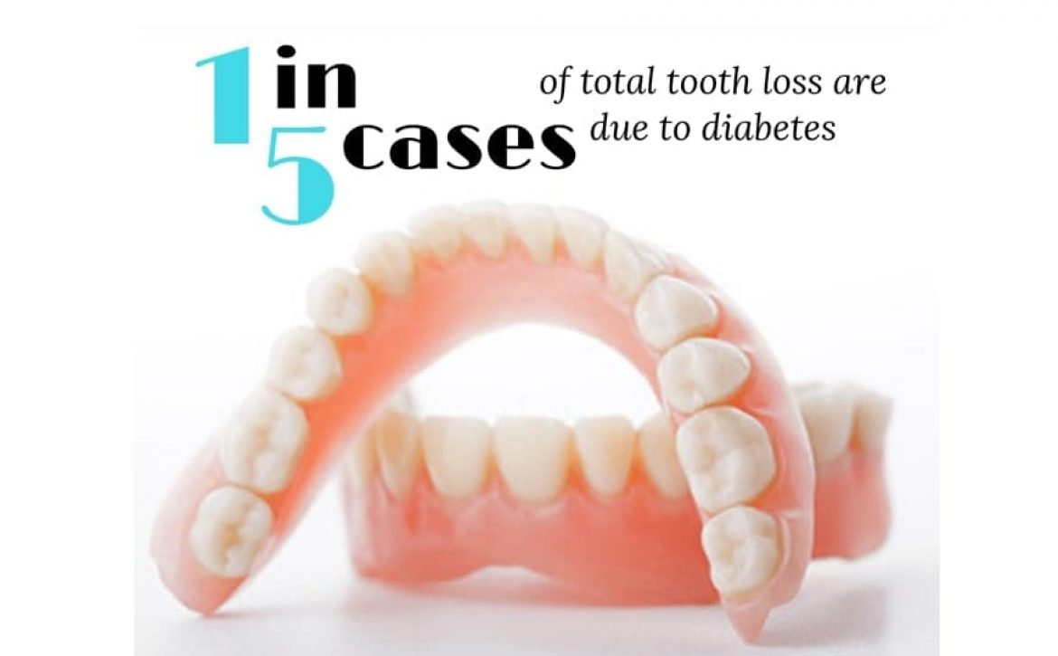 Should Dentists Screen for Diabetes?
