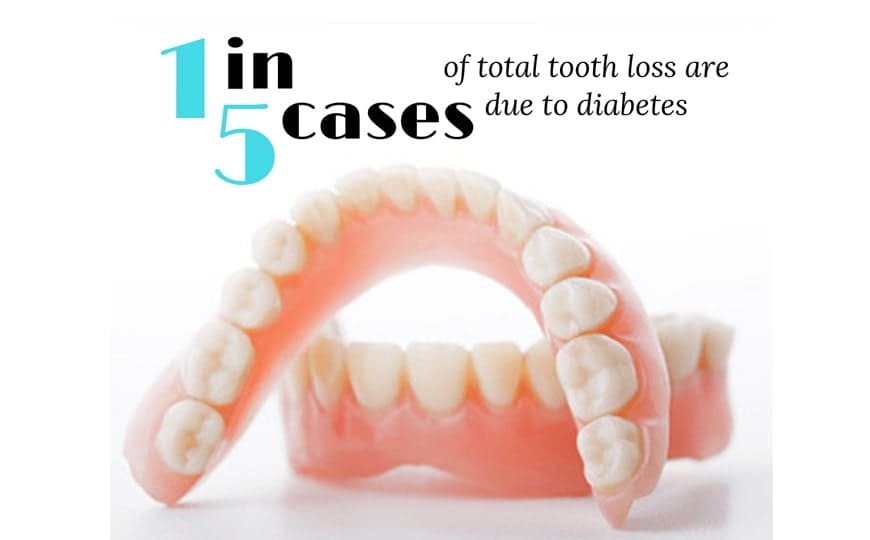 Should Dentists Screen for Diabetes?