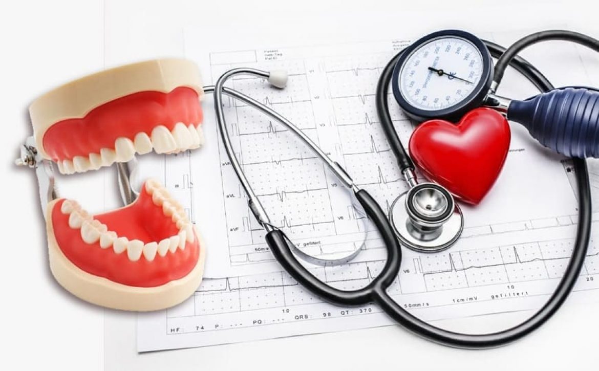 Understanding Blood Pressure and Oral Health Implications