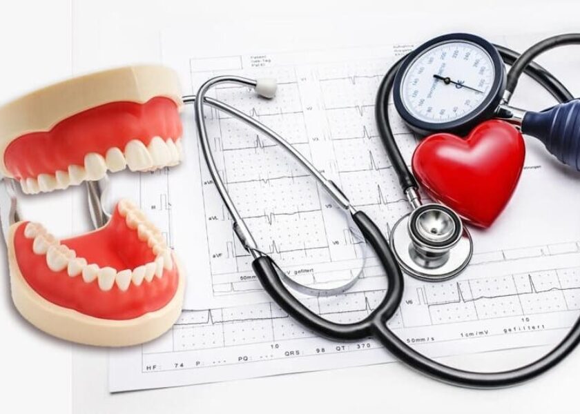Understanding Blood Pressure and Oral Health Implications